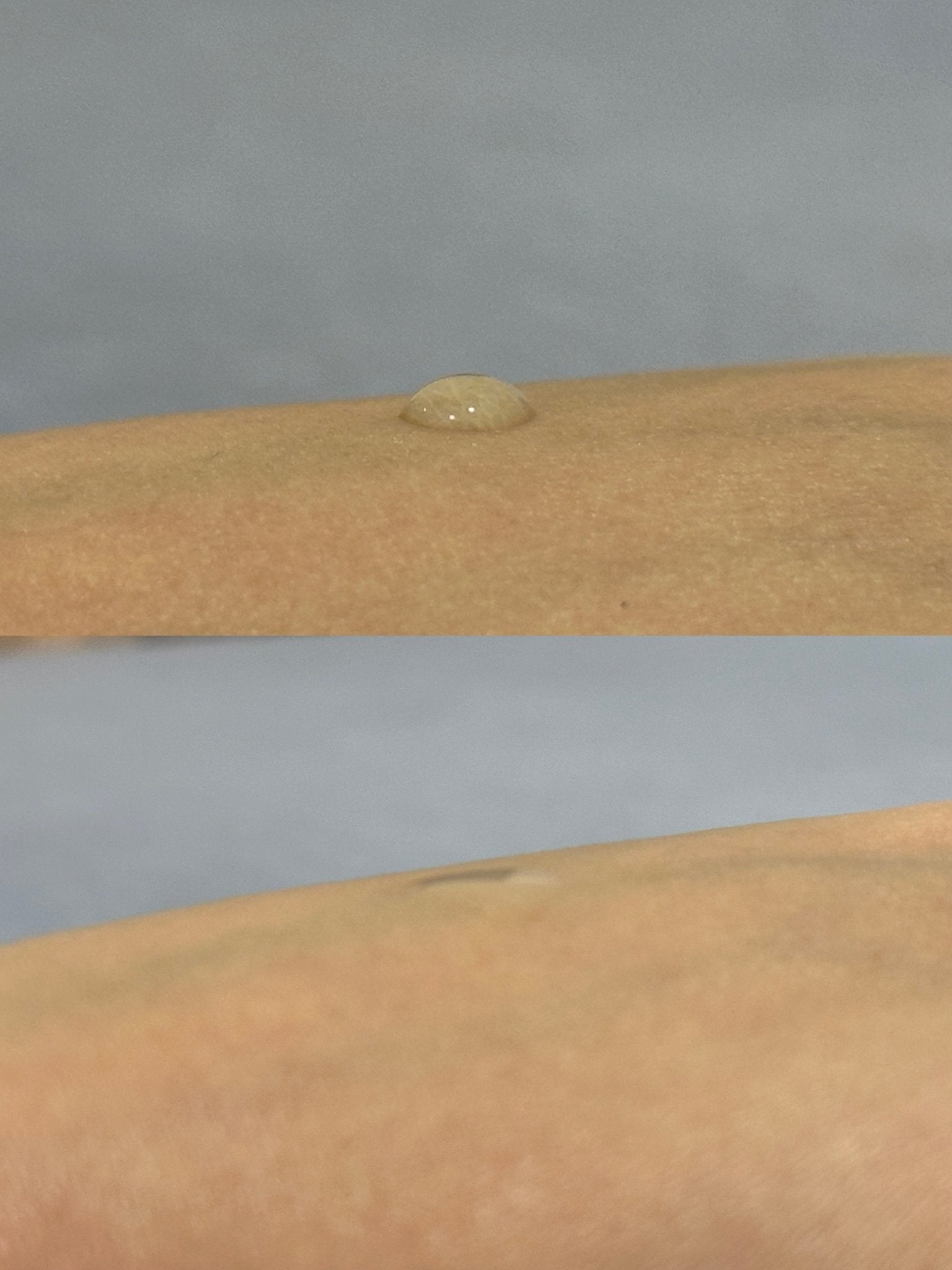 0.2 mm 可溶透明質酸微針滾輪 - LEMOI - PEAU