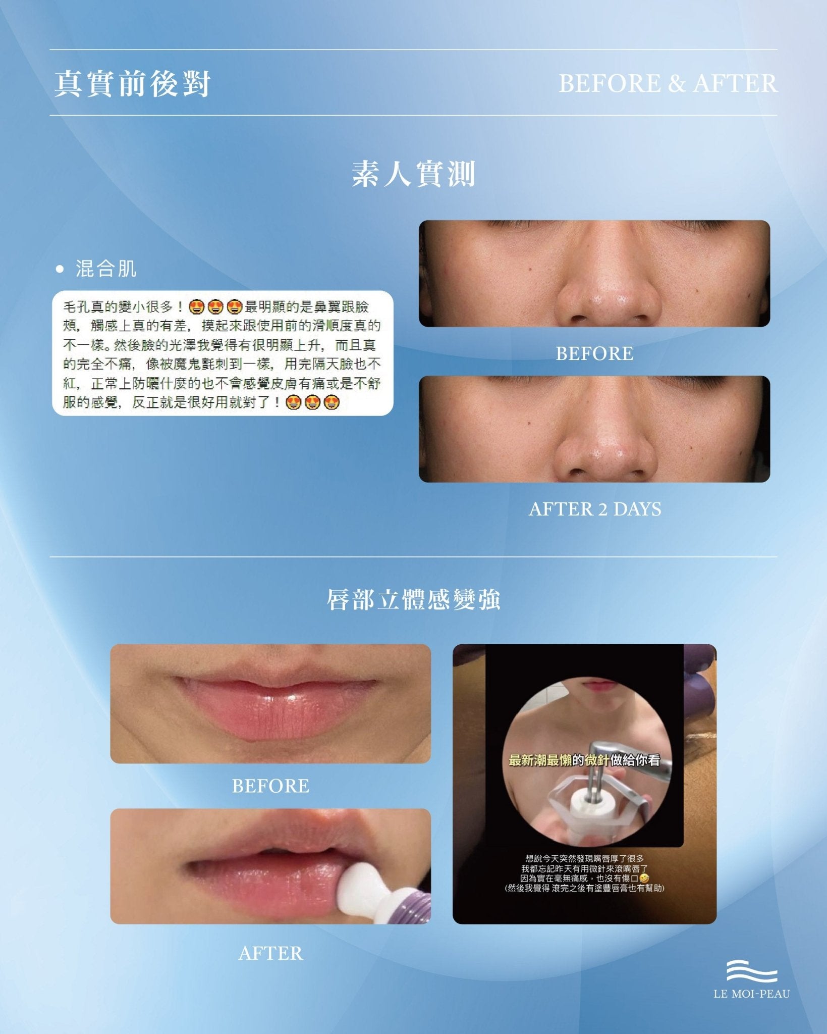 水玻超導滾輪 0.2mm - LEMOI - PEAU