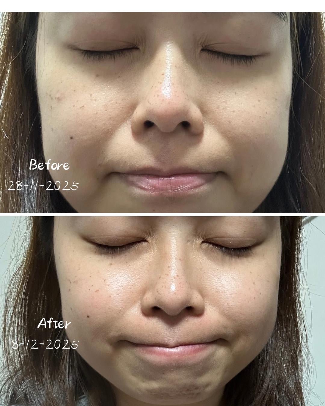 藏紅玫瑰御顏油 4ml(滿額贈) - LEMOI - PEAU